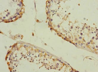 Polyclonal Rabbit anti-Human CAMSAP2 Antibody (IHC)