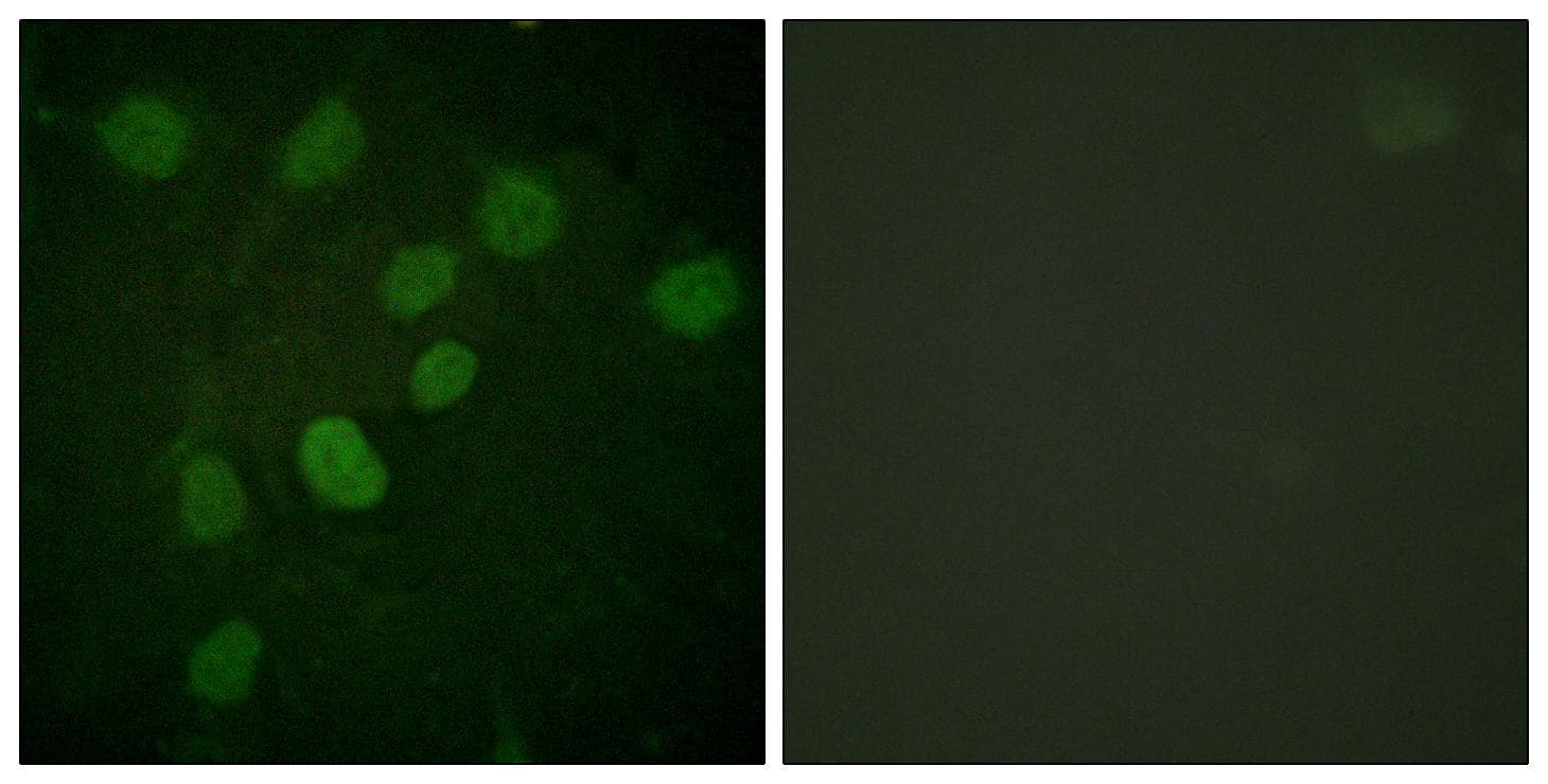 Polyclonal Rabbit anti-Human PRKDC / DNA-PKcs Antibody (phospho-Thr2638, IF)