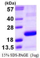 Human Prostaglandin D Synthase Protein (Recombinant His)