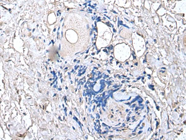 PTP4A1 / PRL-1 Antibody