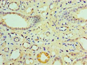 Polyclonal Rabbit anti-Human NR1I3 / CAR Antibody (WB)