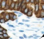 Cytokeratin AE1+AE3 Antibody (clone AE1 & AE3)
