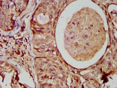 Polyclonal Rabbit anti-Human MAD2L1 / MAD2 Antibody (aa2-205)
