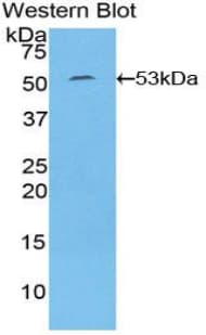 IL6 / Interleukin 6 Antibody (aa29-212, FITC)