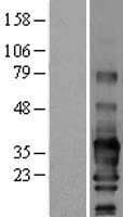 SCN3B Protein (Over-Expression Lysate Myc-DDK (Flag))