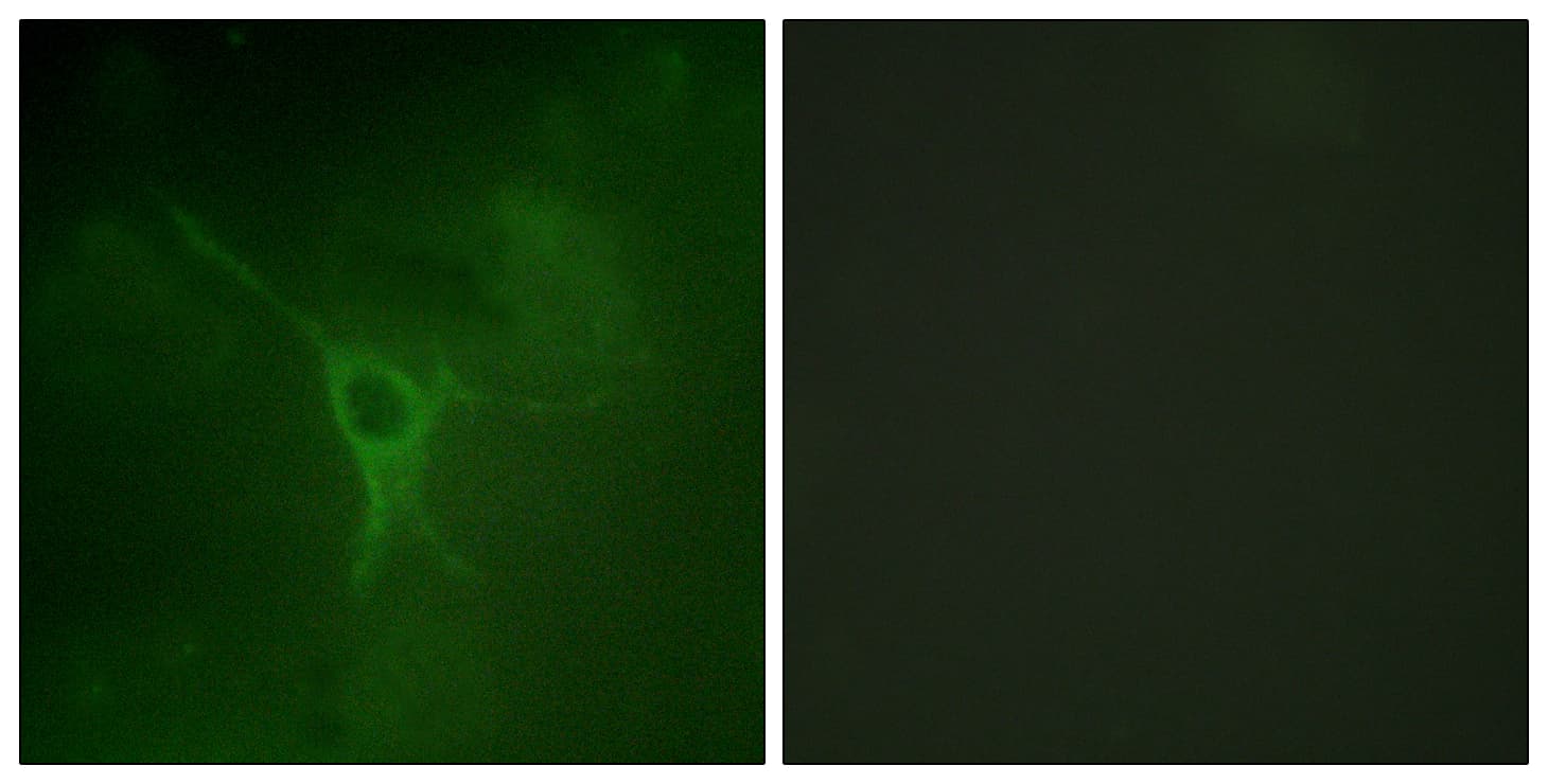 GFAP Antibody (phospho-Ser38)
