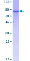 Human CASQ2 / Calsequestrin 2 Protein (Recombinant GST)
