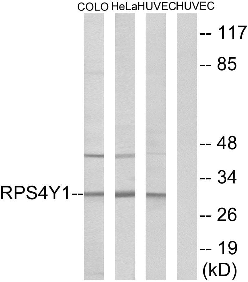 RPS4Y1 Antibody