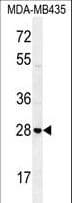 STX19 / Syntaxin 19 Antibody (aa250-279)