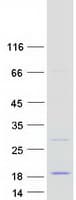 Human WIT1 Protein (Recombinant Myc-DDK (Flag))