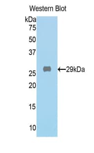 GLB1 / Beta-Galactosidase Antibody (aa192-432, APC)