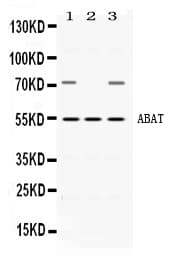 ABAT Antibody