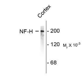 Polyclonal Chicken anti-Bovine NEFH / NF-H Antibody (IF, WB)