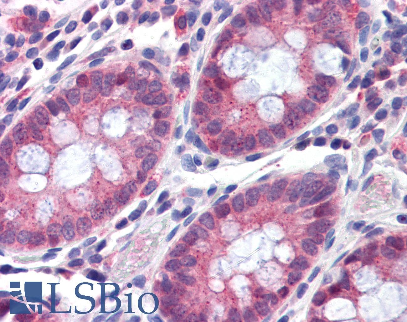 IHC-plus™ Polyclonal Rabbit anti-Human TMPRSS4 Antibody (Internal)