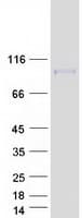 Human CD71 / Transferrin Receptor Protein (Recombinant Myc-DDK (Flag))