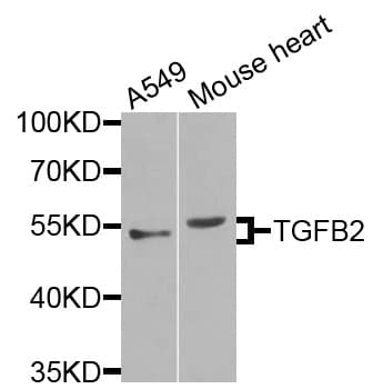 TGFB2 / TGF Beta2 Antibody