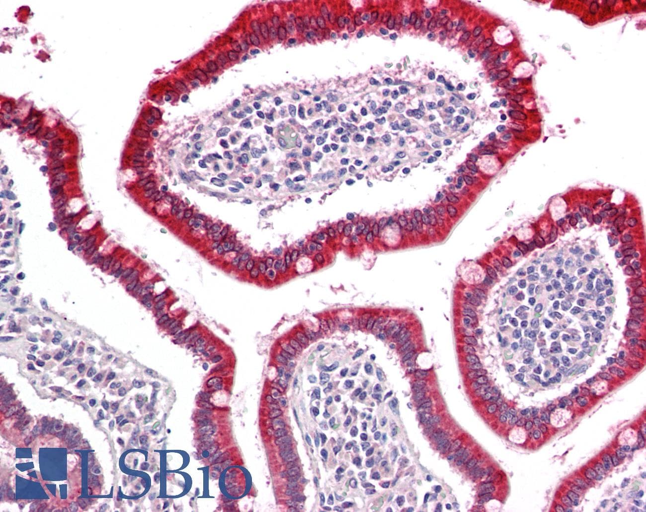IHC-plus™ UGT1A / UGT1A1 Antibody