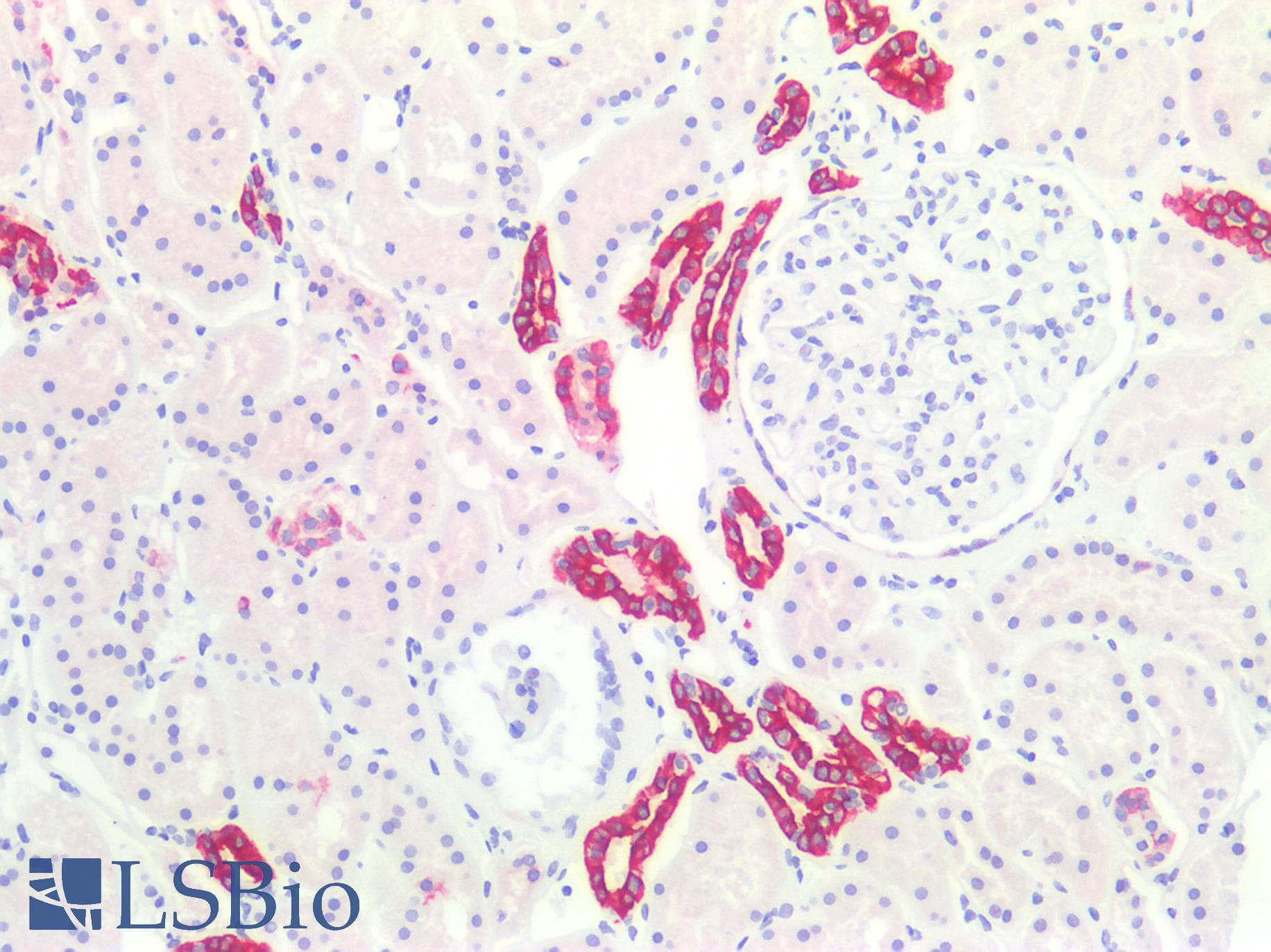 PathPlus™ Monoclonal Mouse anti-Human KRT19 / CK19 / Cytokeratin 19 Antibody (clone BA-17, IHC, WB)