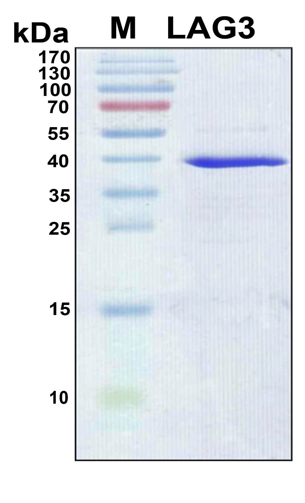 Human LAG3 Protein (Recombinant 6His, N-terminus)