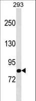 Polyclonal Rabbit anti-Human TBC1D10B Antibody (aa781-808, WB)