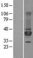Human BCAT1 / ECA39 Protein (Over-Expression Lysate Myc-DDK (Flag))