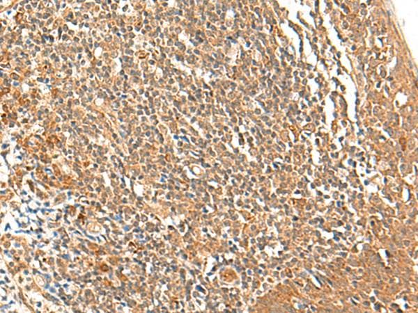 Polyclonal Rabbit anti-Human TSHB / TSH-Beta Antibody (IHC)