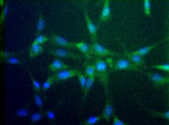 CCR2 Antibody (aa20-100, Biotin)