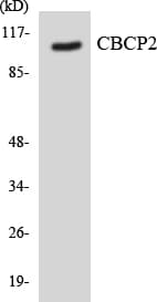 AGBL2 / CCP2 Antibody (aa718-767)