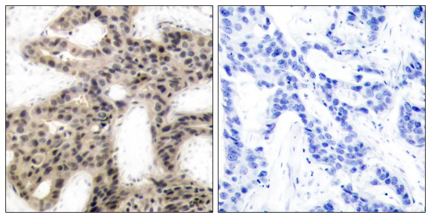 Polyclonal Rabbit anti-Human EIF4EBP1 / 4EBP1 Antibody (phospho-Thr45, IHC, WB)