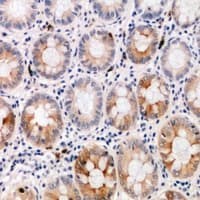 SHBG Antibody