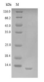 Vaccinia Virus K3L/VACWR034 Protein (Recombinant 6His, N-terminus)
