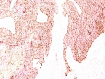 CHGA / Chromogranin A Antibody (clone SPM339)