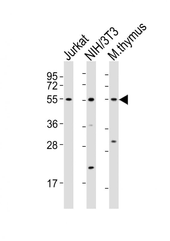 AML1 / RUNX1 Antibody (aa426-459)