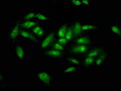 NSUN2 Antibody
