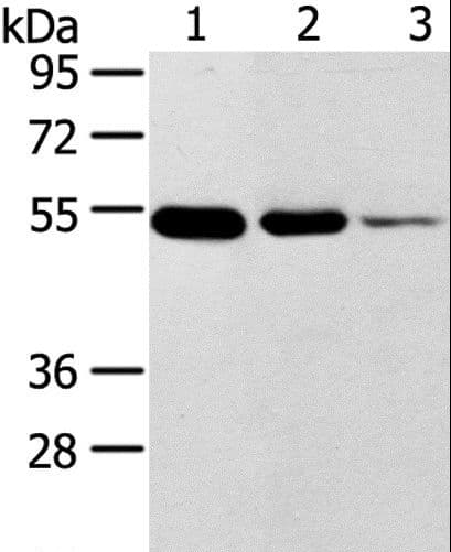 Polyclonal Rabbit anti-Human TMPRSS11F Antibody (IHC, WB)