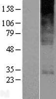 YIPF5 Protein (Over-Expression Lysate Myc-DDK (Flag))