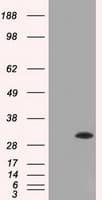ERCC1 Antibody (clone OTI1C6)