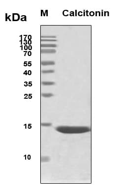 Human Calcitonin Protein (Recombinant 6His, N-terminus)