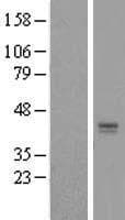 L3 / LASS2 Protein (Over-Expression Lysate Myc-DDK (Flag))
