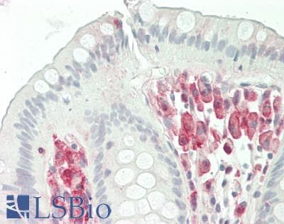 IHC-plus™ Polyclonal Rabbit anti-Human NCF2 / NOXA2 / p67phox Antibody (IHC, IF, WB)