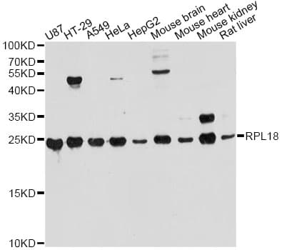 RPL18 / Ribosomal Protein L18 Antibody