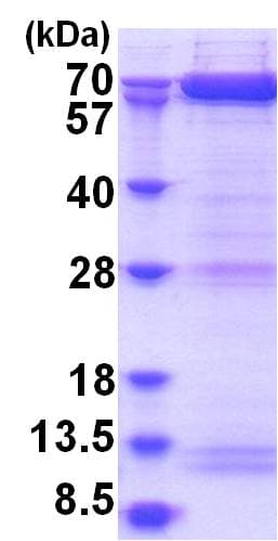 Human PAK4 Protein (Recombinant His)