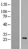 EID1 / EID-1 Protein (Over-Expression Lysate Myc-DDK (Flag))