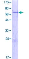 Human ZNF414 Protein (Recombinant GST)