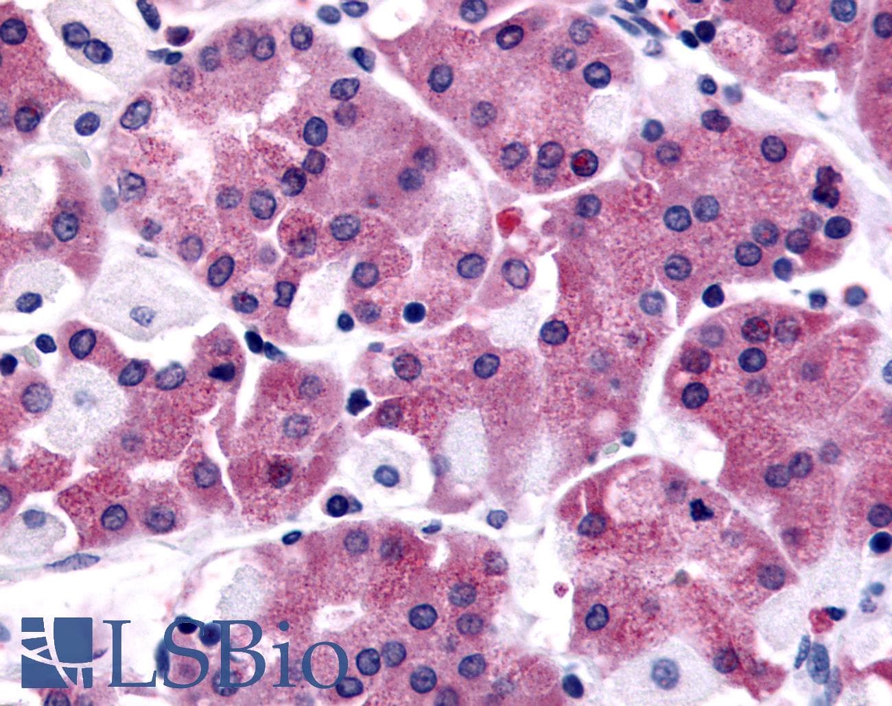 PathPlus™ SLC7A11 / XCT Antibody (N-Terminus)