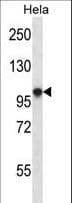 HCN1 Antibody (aa860-889)