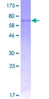 Human OPG / Osteoprotegerin Protein (Recombinant GST)