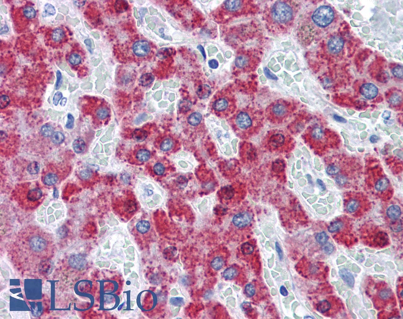 IHC-plus™ TAOK2 / TAO2 Antibody (clone 2E2)