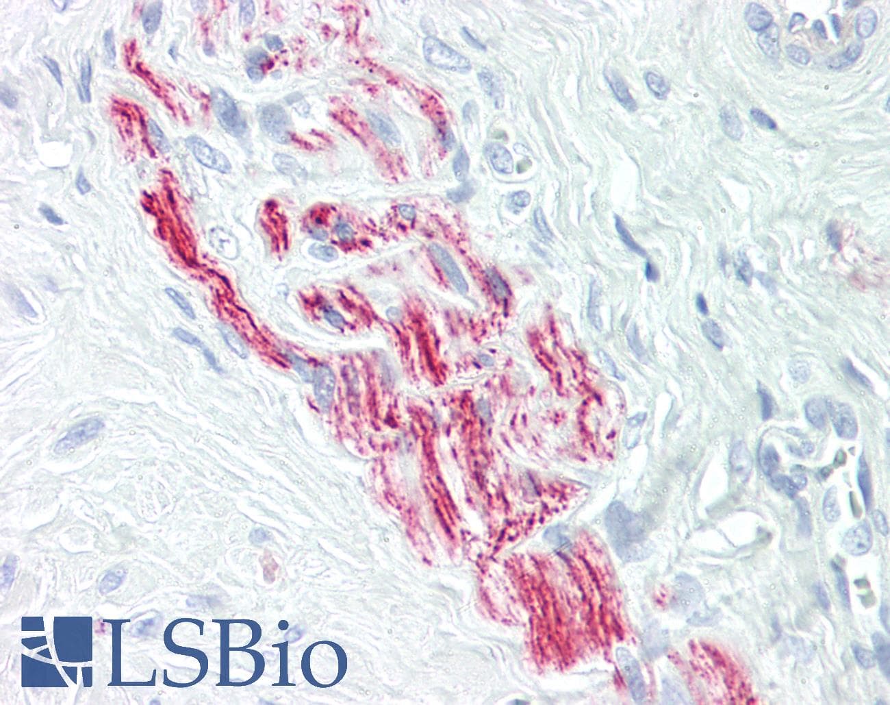 IHC-plus™ BRI3BP Antibody (aa1-50)