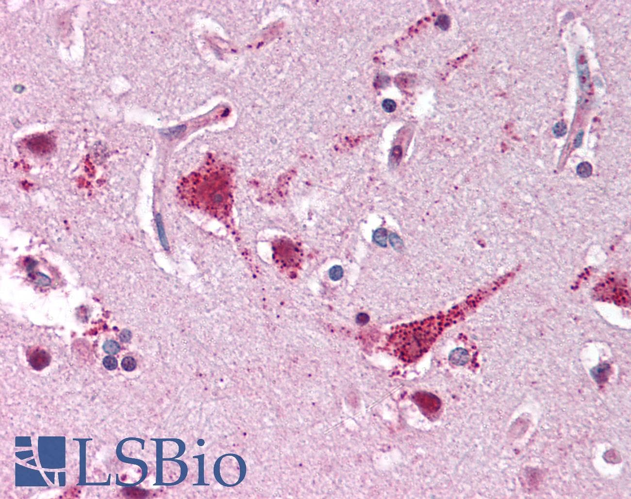 IHC-plus™ XRCC5 / Ku80 Antibody (N-Terminus, clone 9403)